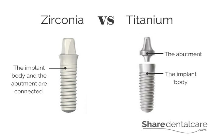 Zirconia vs Titanium Implants