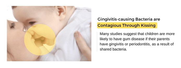 Gingivitis Bacteria are Contagious Through Kissing