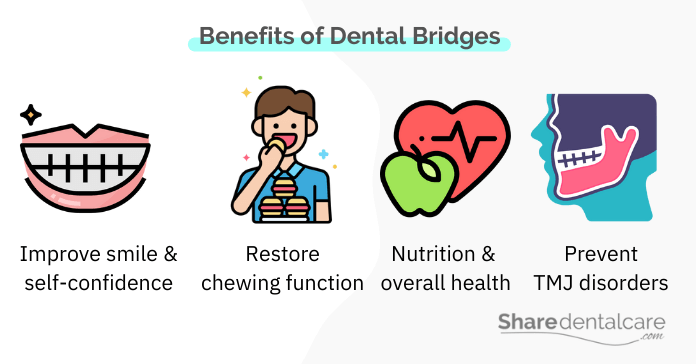 Benefits of a dental bridge for missing bottom teeth 