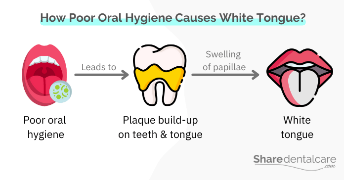 How poor oral hygiene causes white tongue
