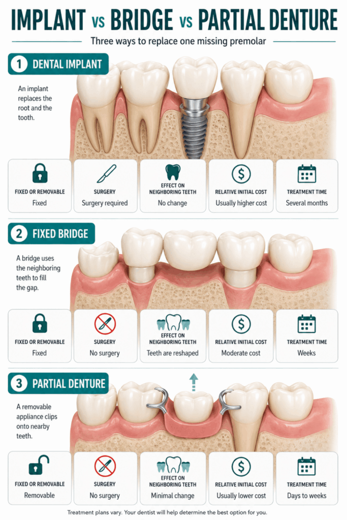 Dental implant, fixed bridge, and partial denture compared by surgery, cost, tooth changes, and treatment time