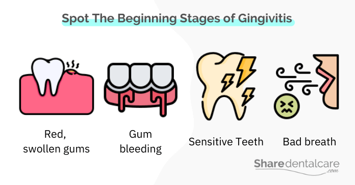 Spot the Beginning Stages of Gingivitis