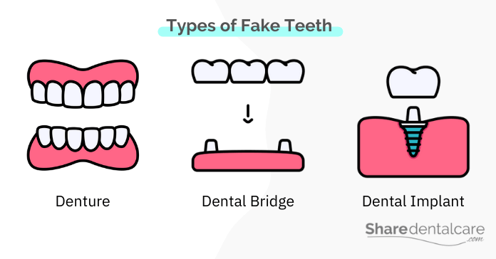 Types of fake teeth include dentures, bridges, & implants