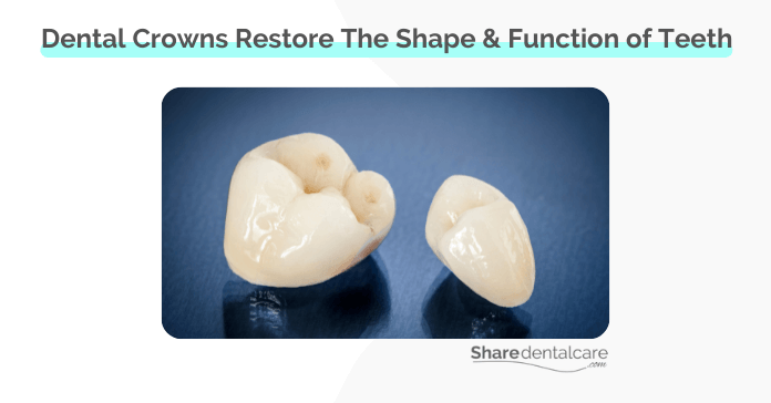 Dental crowns restore the shape and function of broken teeth