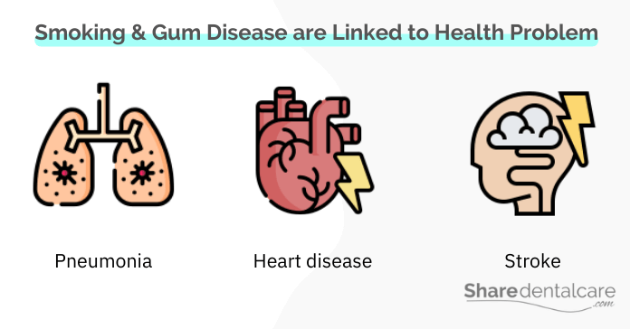 Smoking and gum disease are linked to serious health problems