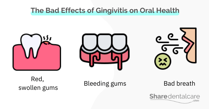 The bad effects of gingivitis on oral health