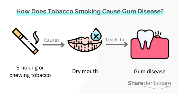 Smoking tobacco causes dry mouth, leading to gum disease