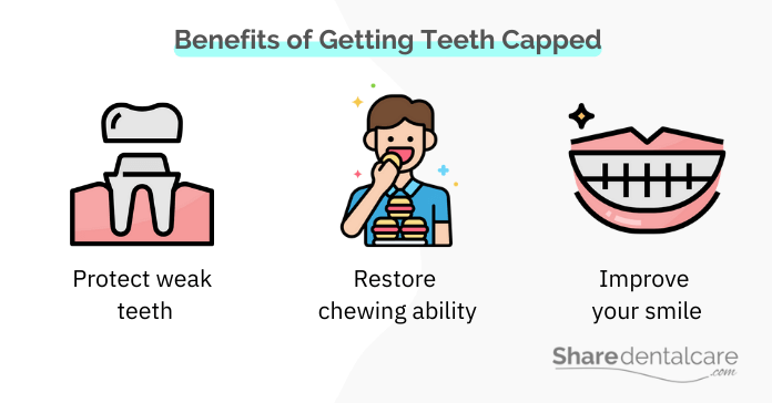 Benefits of Getting Damaged Teeth Capped