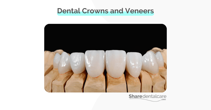 Dental crowns and veneers