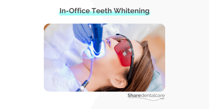 In-office teeth whitening