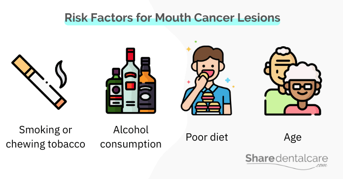 Risk factors for mouth cancer lesions