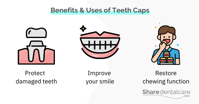 Benefits and uses of teeth caps