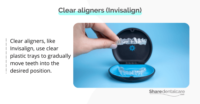 Clear aligners (Invisalign)