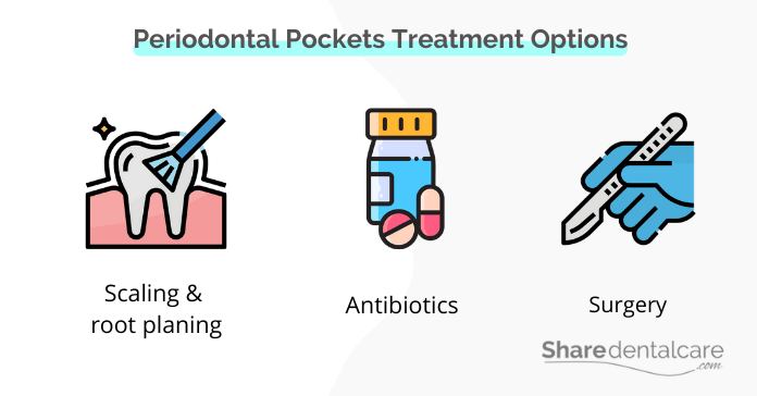 Treatment options for pockets between teeth and gums