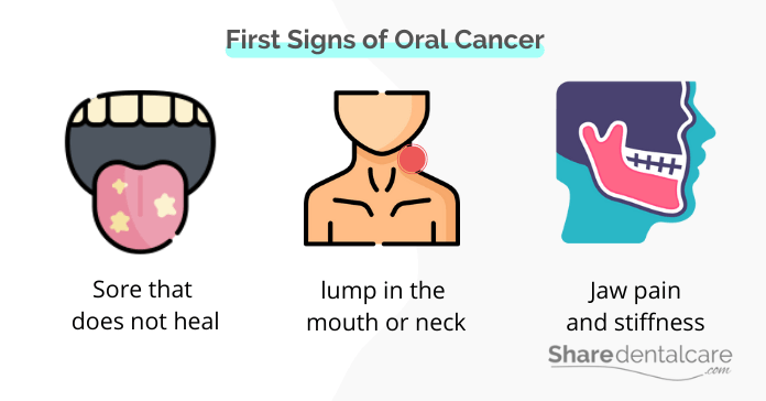 The first signs of oral cancer