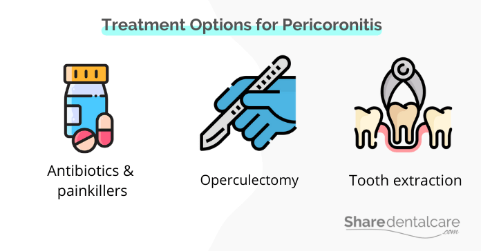 Treatment options for pericoronitis
