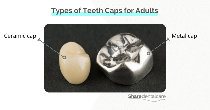 Types of teeth caps for adults