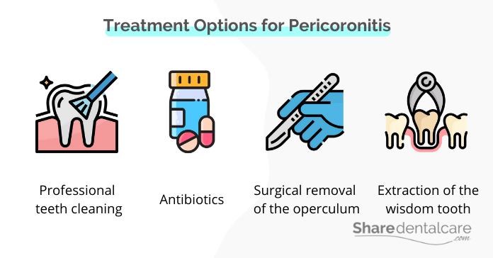 Pericoronitis treatment and home remedy