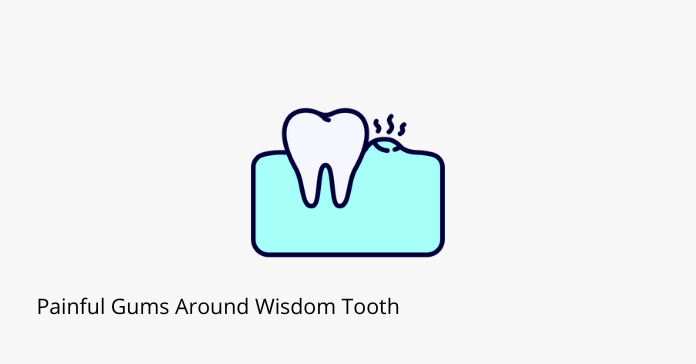 Painful Gums Around Wisdom Tooth - Share Dental Care