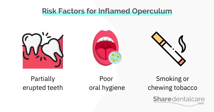 Risk Factors for Inflamed Operculum