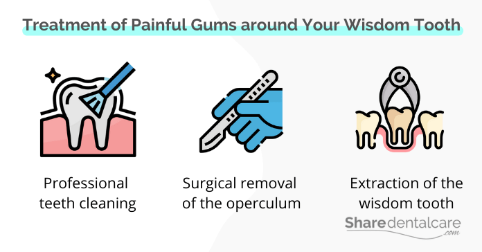 Treatment painful gums around your wisdom tooth