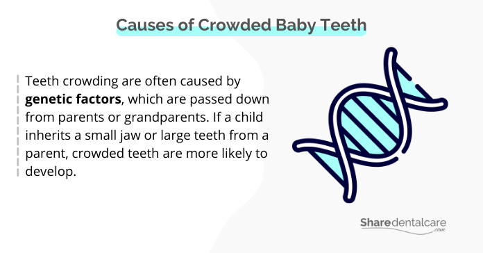 Causes of Crowded Baby Teeth