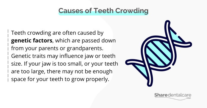 Causes of teeth crowding