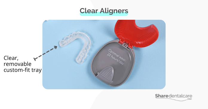 Clear aligners for bottom front teeth crowding