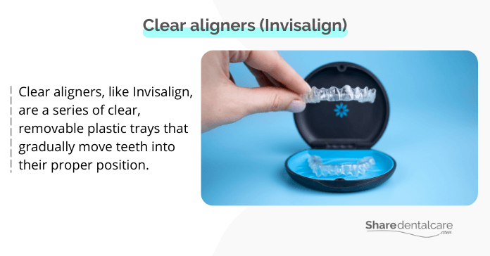 Clear aligners for the treatment of lower teeth crowding