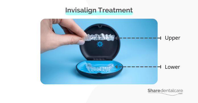 Invisalign treatment for severely crowded teeth