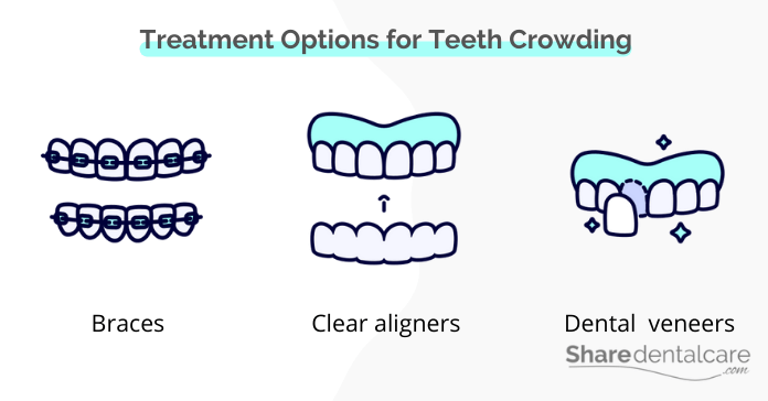 Treatment options for lower teeth crowding