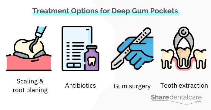 Treatment Options for Deep Gum Pockets