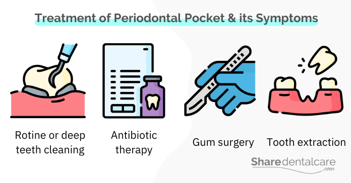 Treatment of Periodontal Pocket & its Symptoms