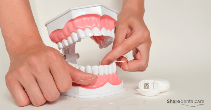 Floss properly to prevent bleeding gums