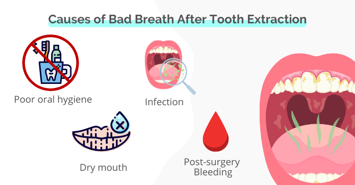 Causes of Bad Breath After Tooth Extraction
