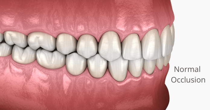 Teeth with normal occlusion