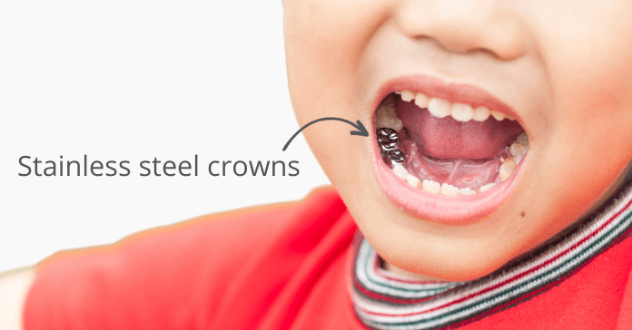 A kid receives a stainless steel crown