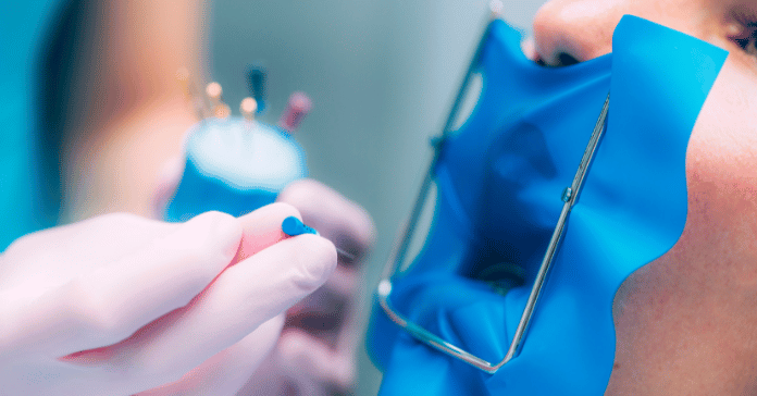 Dentist performing endodontic root canal treatment with rubber dam isolation and endodontic files.