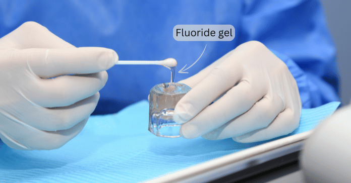 Dentist preparing fluoride gel for tooth enamel protection and cavity prevention.