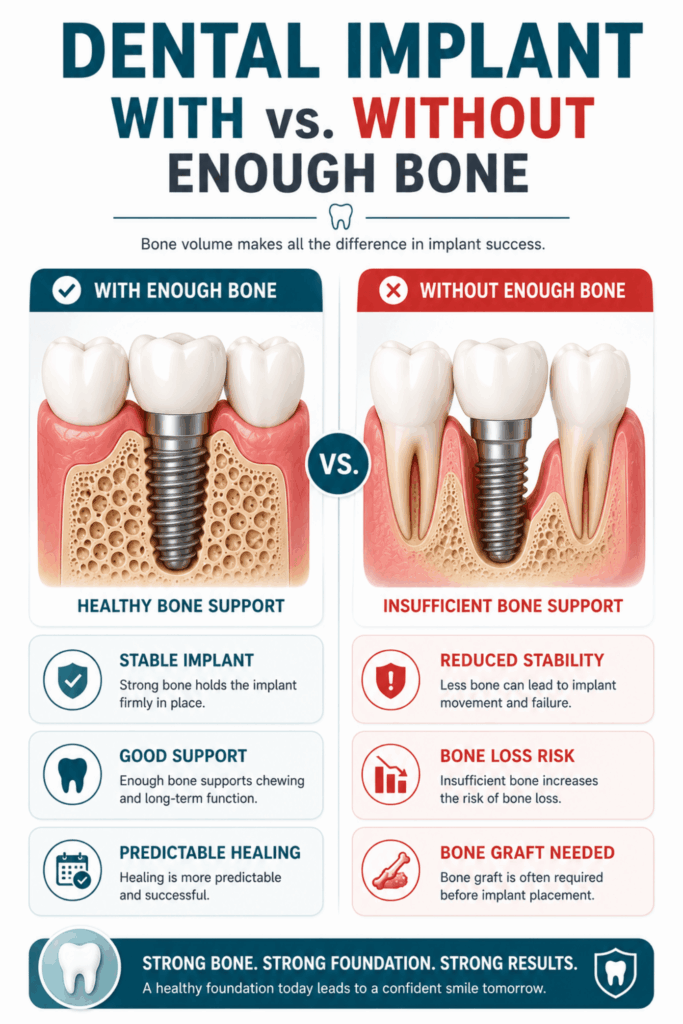 Side-by-side comparison showing a dental implant with adequate bone support versus insufficient bone support and related outcomes.