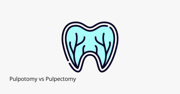 Pulpotomy vs Pulpectomy: Differences in Primary Teeth Treatment - Share ...