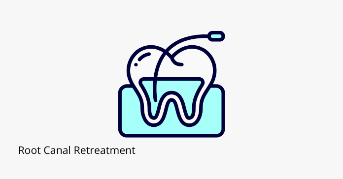 Root Canal Retreatment: When Endodontic Retreatment Is Needed - Share ...