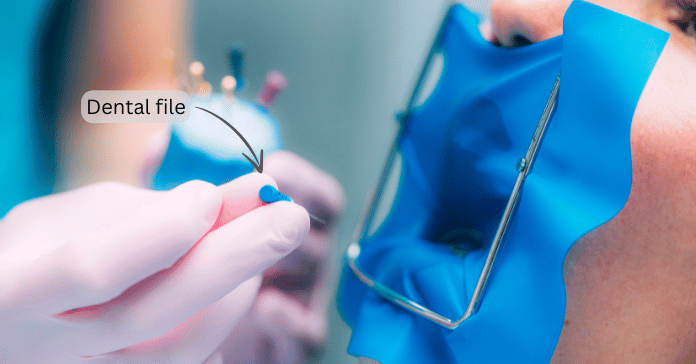 Dentist holding a dental file before cleaning and shaping the root canal while a patient is isolated with a rubber dam. Cleaning and shaping inside the tooth can inflame nearby tissues and may cause tooth pain for 3 to 5 days after root canal treatment.