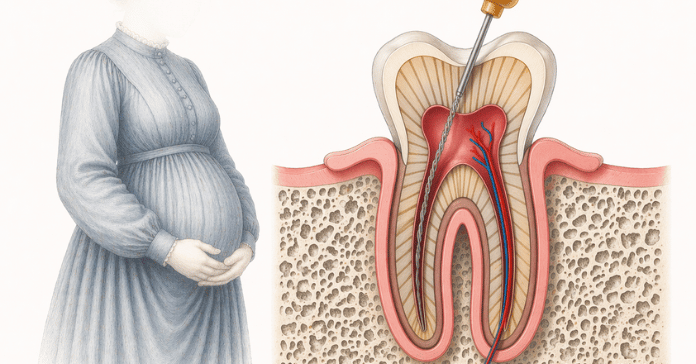 A detailed dental illustration shows root canal treatment inside a tooth with infected pulp while a pregnant woman stands beside the diagram to represent treatment during pregnancy.