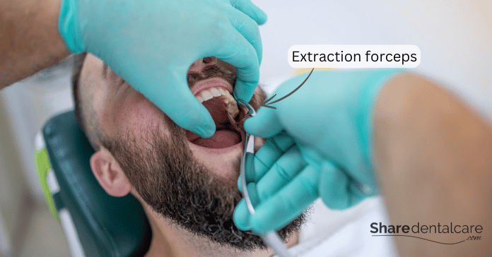 Dentist performing tooth extraction using extraction forceps on a patient.