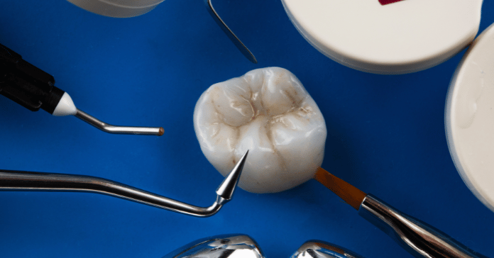Dental crown material and tools showing how different materials affect dental crown cost.