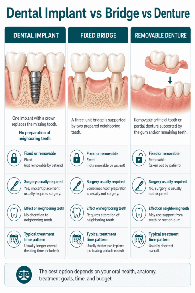 Comparison of an implant, fixed bridge, and removable denture for replacing a missing tooth.