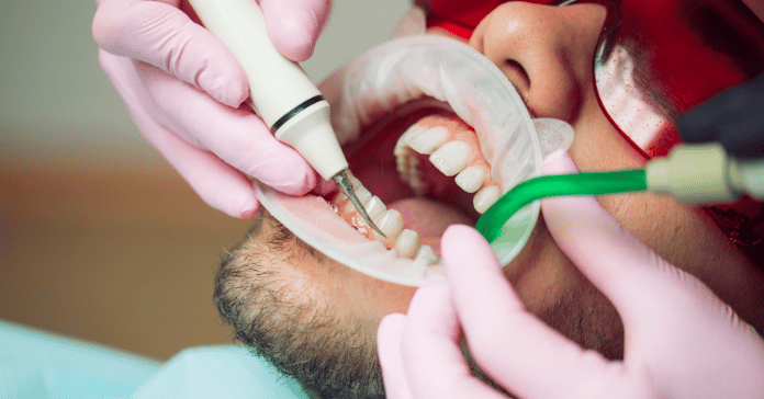 Dentist performing scaling and polishing procedure to remove plaque and tartar from teeth.