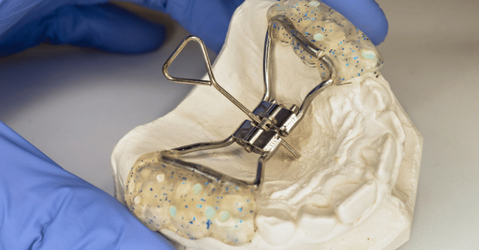 rthodontic palatal expander with key on dental model used for widening the upper jaw.