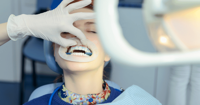 Woman undergoing professional bleaching treatment at dental clinic.